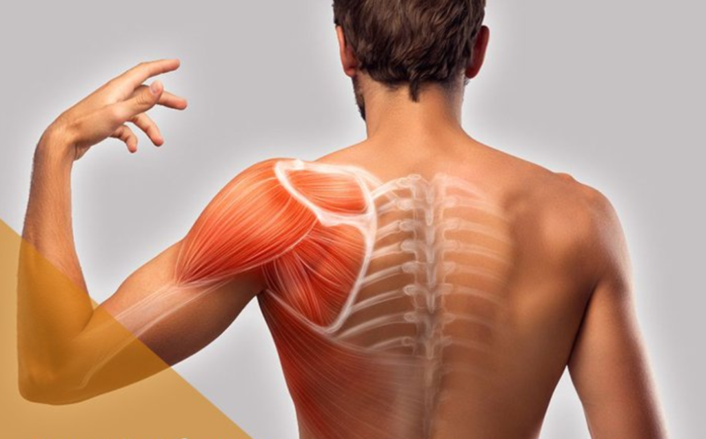 Cơ vai là vị trí chấn thương phổ biến trong câu lông